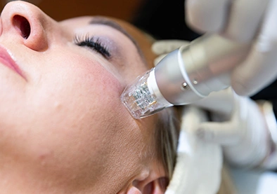 acne-treatment